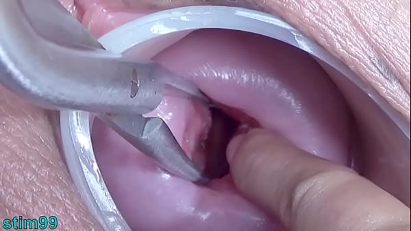 Cervix and Pee Hole Inflation with Injections for Japanese Lesbians